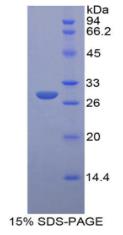 SDS-PAGE (Igf2r-1729R).jpg